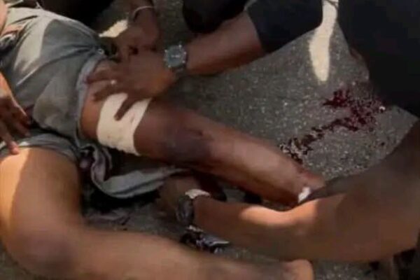 IGBOHO’S SECURITY TEAM INJURED IN OYO FORES